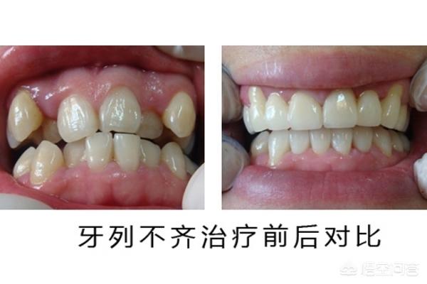 平湖最新24小时牙医在线咨询方法分析(最方便真实的平湖有没有24小时牙医方法)