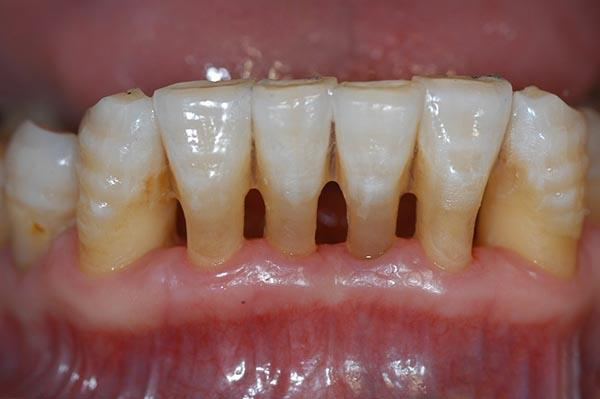 平湖最新24小时牙医在线咨询方法分析(最方便真实的平湖有没有24小时牙医方法)